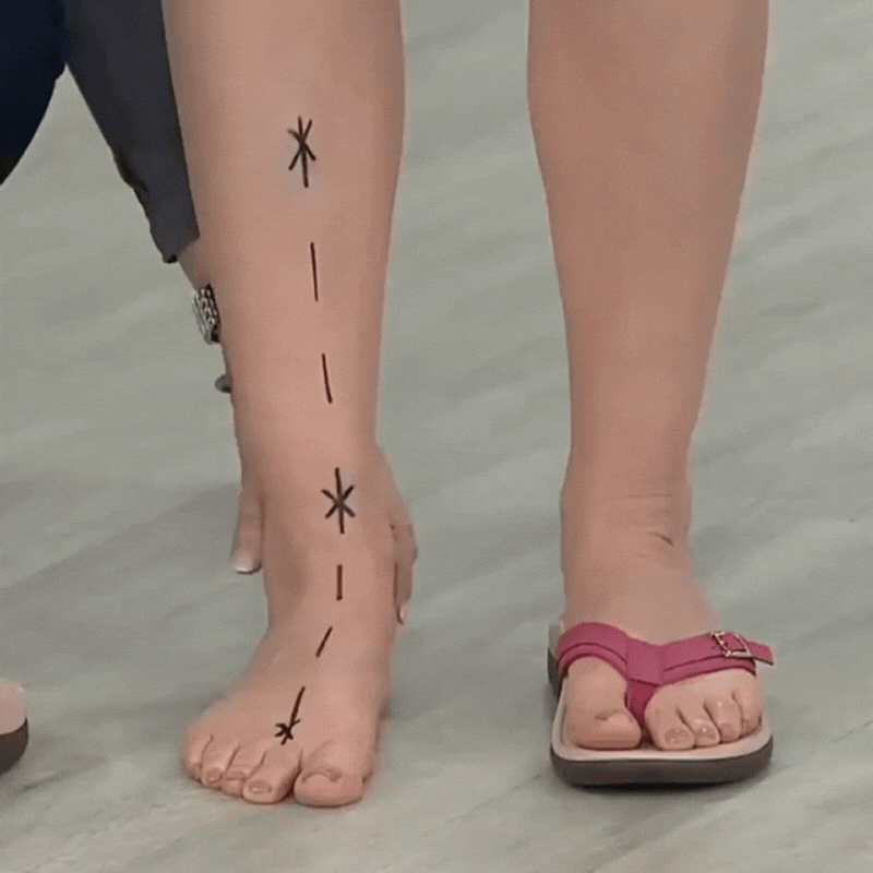 Mira | Dames Teenslippers Met Voetbed Voor Ultiem Comfort 6